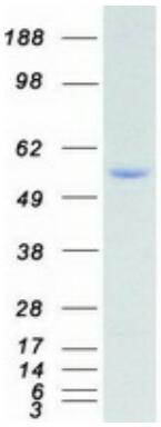 Coomassie blue staining of purified RPS6KB2 protein.